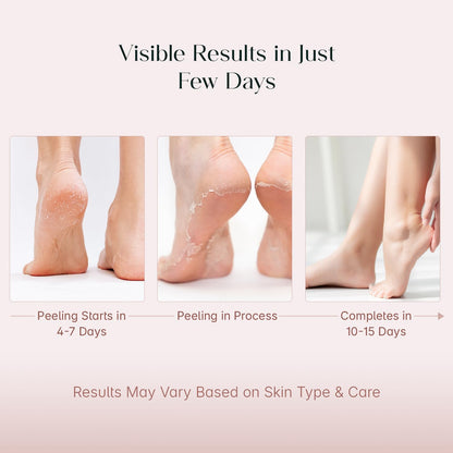 Foot Peeling Mask