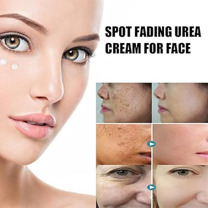 Spot Fading Urea Cream