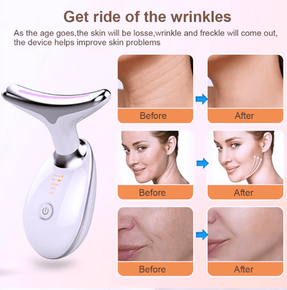 Anti Aging and Wrinkle Removal Massager
